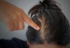 How to stop haifall?
