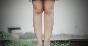 Swelled Legs